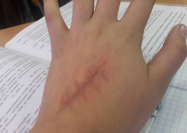 ПЛАВИ КИТ: Опасна игра која подстиче децу на самоубиство стигла и у Хрватску